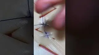 Х-ОБРАЗНЫЙ ШОВ | SCALPEL.MED 