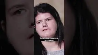 You Can't Ask That: Facial Differences #Shorts #Disability #Inclusion