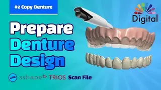 Digital Highlight - Prepare Denture Design with 3Shape: (2) Copy Denture