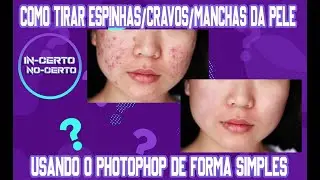 COMO TIRAR ESPINHAS/CRAVOS/MANCHAS DA PELE USANDO O PHOTOSHOP DE FORMA SIMPLES | TUTORIAL.