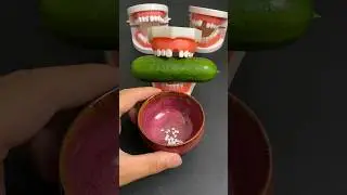 नकली दांत लगाने का खास तरीका || Tooth Implant Procedure