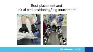 Peaks and Pitfalls of Positioning for Intertrochanteric Proximal Femur Fractures