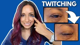 Why Is My Eye Twitching? Eye Doctor Explains
