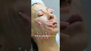 Don't make this mistake! Thread lift!