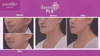 Profile Beauty - Thermage Promotion Video 1'56''