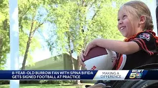 Young Joe Burrow fan with spina bifida gets signed football at practice