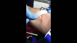 blood donation phlebotomy / flebotomi kan bağışı / идеальная кровопускание  сдача крови