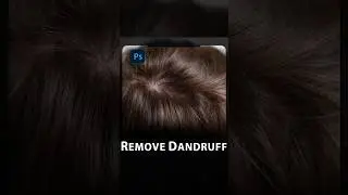 Remove dandruff in photoshop #shorts