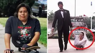 She was born without a lower body. You won't believe this is what happened to her!
