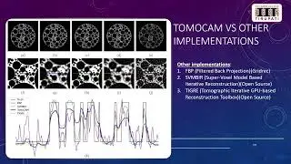Detection Of Abnormalities in Chest and Abdominal region on Low Dose CT Scans using TOMOCAM