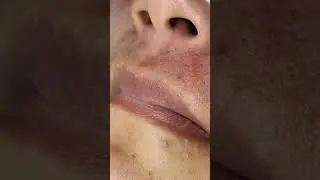 Best Satifying videos for Relaxation with Rat Tana Acne Spa =Short