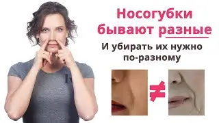 Как убрать носогубные складки? Все нюансы здесь!