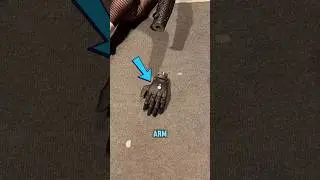 Wireless Bionic Hand That Shocked Everyone 
