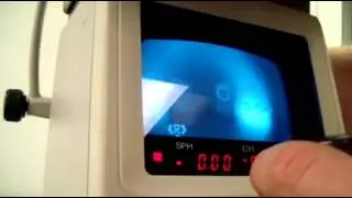 Nidek ARK-900 Auto Ref/Keratometer