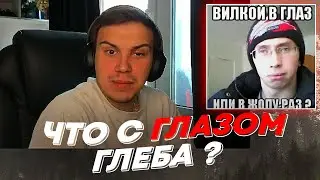 ЧТО С ГЛАЗОМ ГЛЕБА ? | freakanutiy