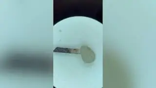 Сравнение иммунной системы насекомых и человека 