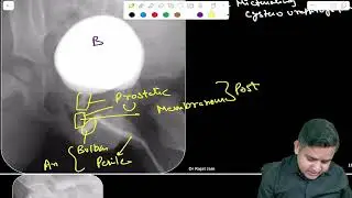 Let’s learn MCU #neetpg2024 #neet2024