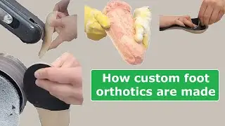 How custom foot orthotics are made