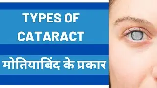 मोतियाबिंद के प्रकार I Types Of Cataract