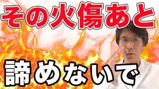 【その火傷…諦めるな！】１度できてしまった火傷痕はもう消えない？【Q&A切り抜き】