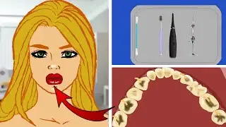 ASMR  Teeth Treatment Removal of Girl Parasite by | Teeth Deep Cleaning