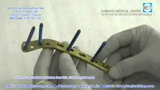 4.5mm Lateral Tibial Head Buttress Plate - Left with Safety Lock System, Titanium - Ti -SF-165.105L