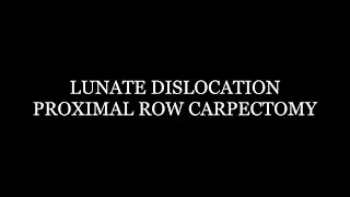 Lunate Dislocation and Proximal Row Carpectomy