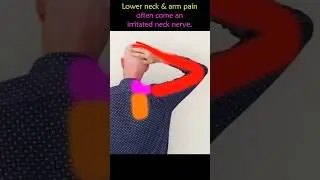 Exercise To Fix A Pinched Nerve In Neck Causing Arm Pain