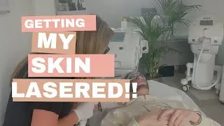 GETTING MY SKIN LASERED (IT HURT SO MUCH!) #skits #spa #skintreatment