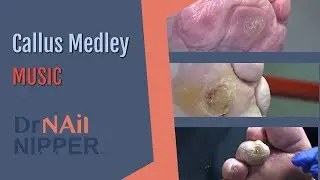 Callus Tuesday - Video Medley Full Video (2021)