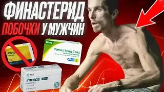 ФИНАСТЕРИД ОПАСЕН ? ПОБОЧКИ ОТ ФИНАСТЕРИДА. Либидо, гинекомастия, тестостерон, депрессия, дисфункция