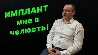 Потерял зуб? Узнай всё о современных имплантах.