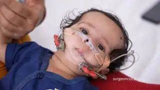 Baby's Life Changing Surgery done by Dr. Sunil Richardson