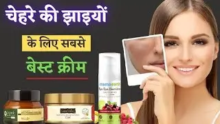 Best Cream for pigmentation || झाईयो के लिए सबसे अच्छी क्रीम|| Melasma| Women problem