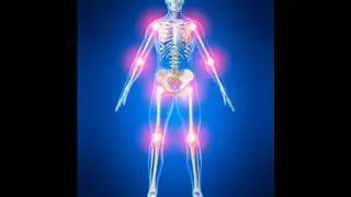 Osteoarthritis Healing Binaural Beats Music | Joints Pain and Bone Healing | Pain Relief