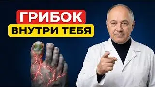 How to get rid of nail and skin fungus forever