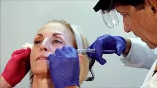 Under Eye Vollure