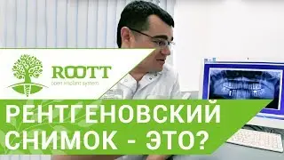 Рентгеновский снимок. 📸 Что показывает рентгеновский снимок полости рта? ROOTT. 12+