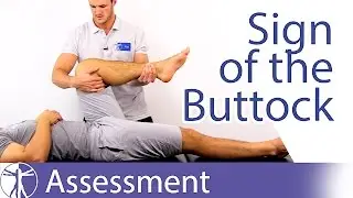 Sign of the Buttock