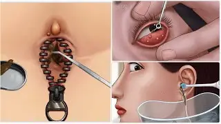 ASMR | zipper Navel Stone Remove Animation