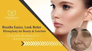Achieving the Perfect Barbie Nose | Rhinoplasty Transformation | Rhinoplasty Nose Before & After