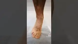 Желудок 