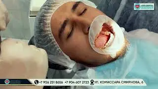 OPERATSYA JARAYONI