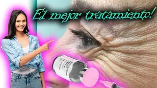 CURSO de TOXINA BOTULINICA ✅ (BOTOX) - Clase Teórica : ARRUGA ESTÁTICA vs ARRUGA DINÁMICA 🔥