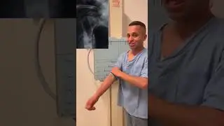 Radiografias de úmero em trauma
