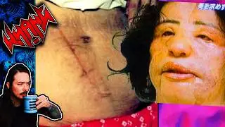 Performed Medical Procedures on Themselves - Tales From the Internet