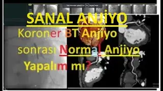 SANAL ANJİYO YETERLİ Mİ?