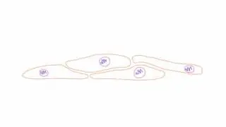 Varicella Zoster Virus (VZV) -  Virology and Pathogenesis