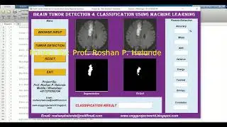 Tumor Identification Using Machine Learning Matlab Project With Source Code Brain Tumor Detection