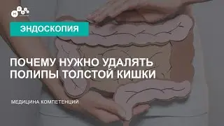 Удаление полипов толстой кишки. Удаление полипов в кишечнике при колоноскопии
